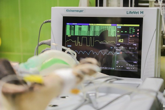 A photo of an electrocardiogram in a hospital setting